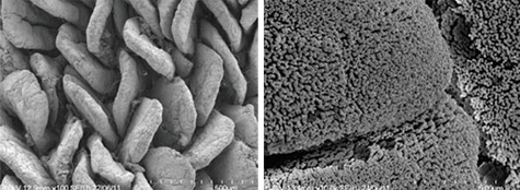 Figura 2. Micrografía electrónica de las vellosidades (izquierda) y micro vellosidades (derecha) del intestino delgado
