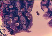 Coccidia multiply in intestinal cells.