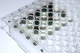  La pruebas ELISA detecta anticuerpos aproximadamente dos semanas después de que la gallina ha sido infectada