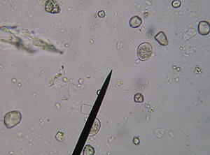 Gut lesions caused by E. mivati.