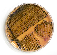  cama de pollos, pollos, pododermatitis, Samonella