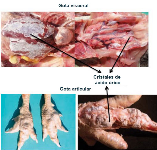 Cristales de ácido úrico- gota en pollo