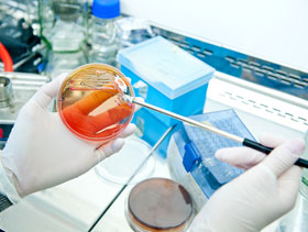 cultivo de bacteria, E coli, El Sitio Avicola