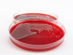 Pseudomonas elsitioavicola