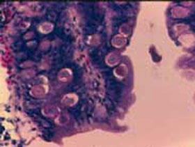 coccidiosis    el sitio avicola