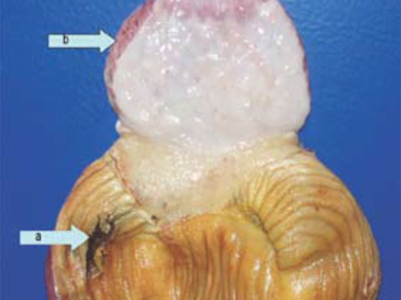 fusariotoxinas